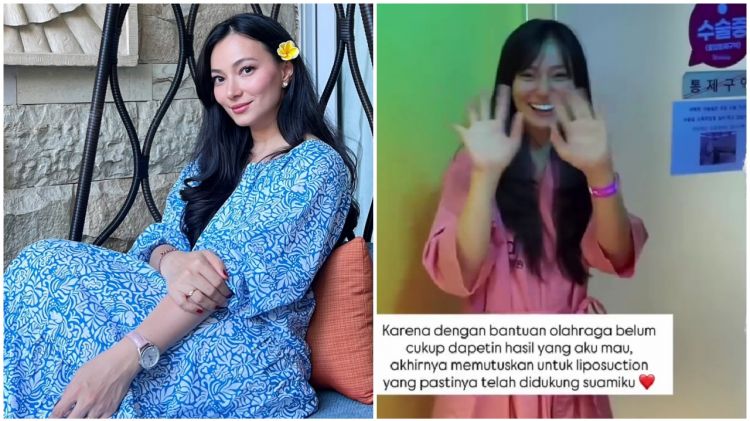 Asmirandah ingin badan ideal pasca melahirkan, putuskan sedot lemak, ini 9 potret hasilnya