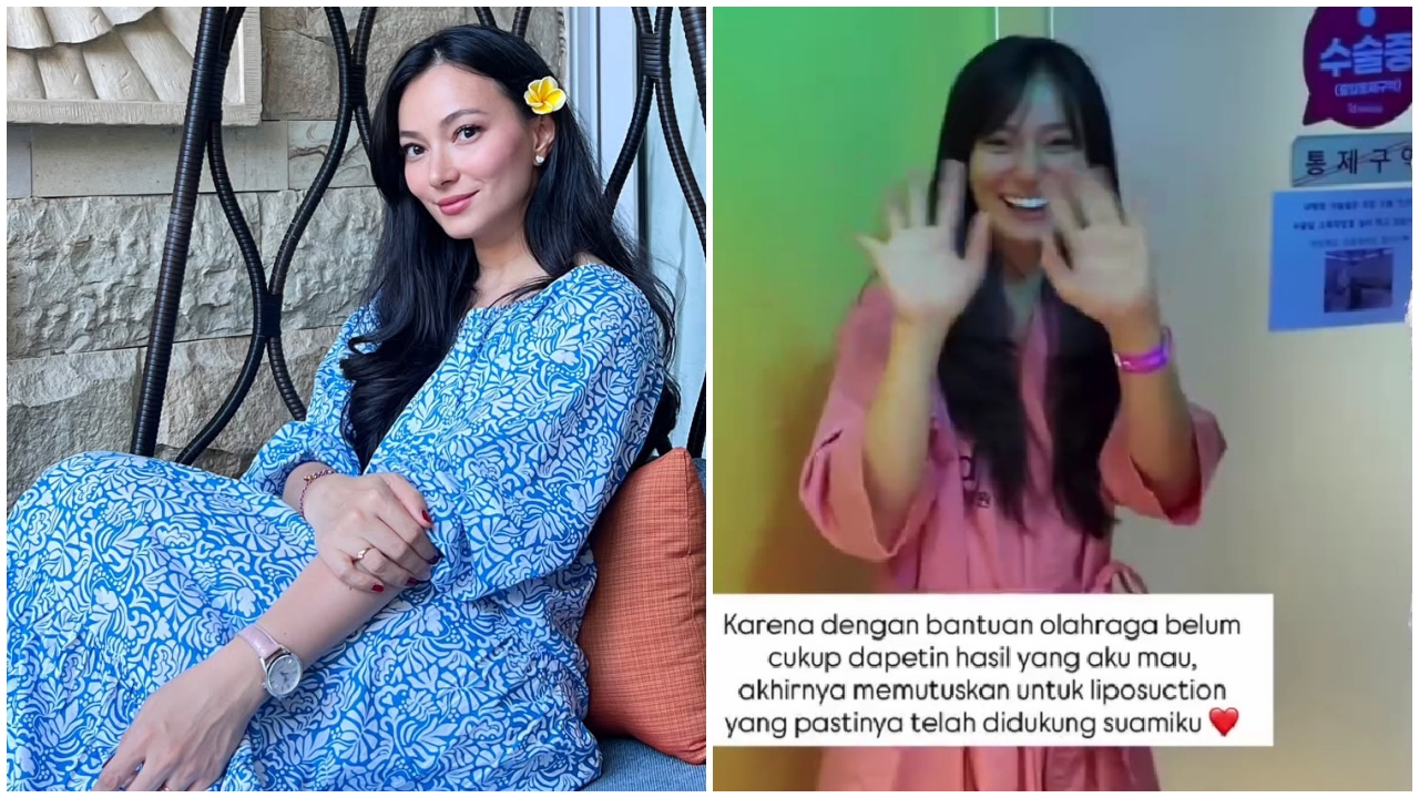 Asmirandah ingin badan ideal pasca melahirkan, putuskan sedot lemak, ini 9 potret hasilnya