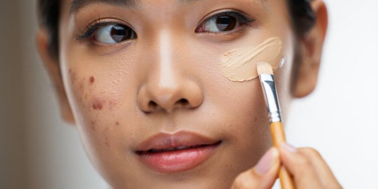 6 Rekomendasi concealer untuk menutupi bekas jerawat, noda hilang seketika