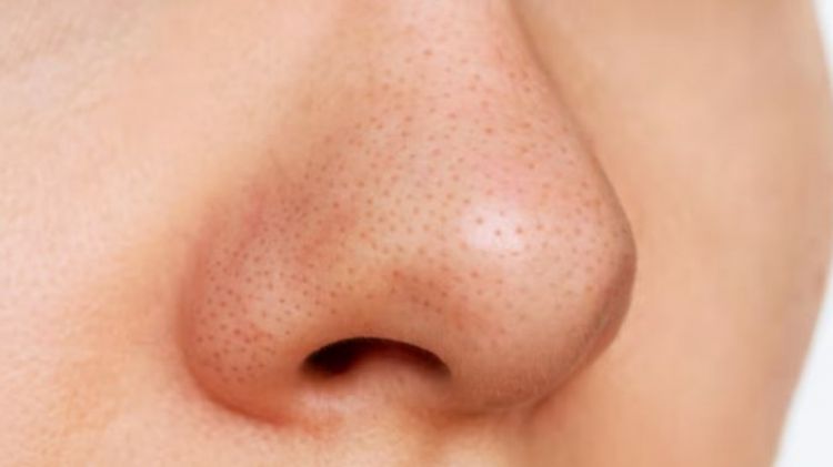 Ampuh bikin wajah mulus tanpa komedo, kecilkan dan bersihkan pori-pori segera dengan 1 jenis tepung