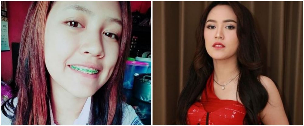 Beda banget, 7 pedangdut koplo saat sekolah vs sekarang, Denny Caknan nyaris nggak dikenalin