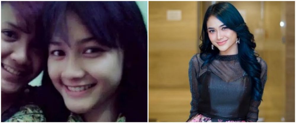 Beda banget, 7 pedangdut koplo saat sekolah vs sekarang, Denny Caknan nyaris nggak dikenalin