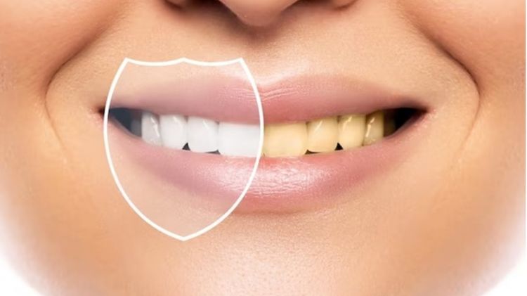 Gigi minim plak dan noda kuning tanpa repot pakai charcoal, wajib tahu trik ini