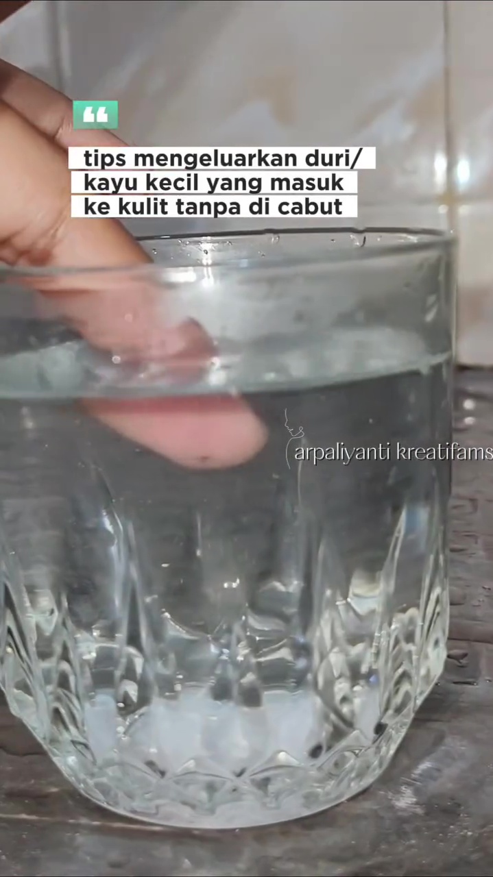 Trik keluarkan duri atau kayu kecil yang masuk ke kulit tanpa dicabut, cukup rendam 1 bahan dapur ini