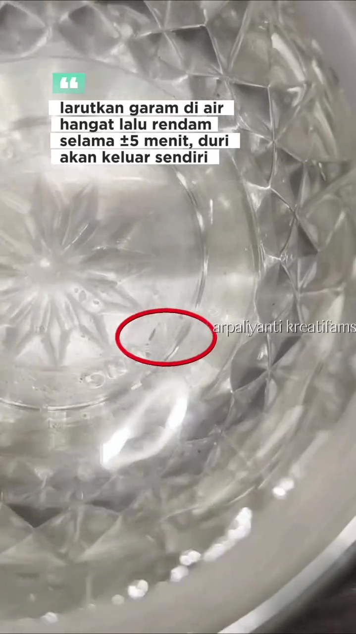 Trik keluarkan duri atau kayu kecil yang masuk ke kulit tanpa dicabut, cukup rendam 1 bahan dapur ini