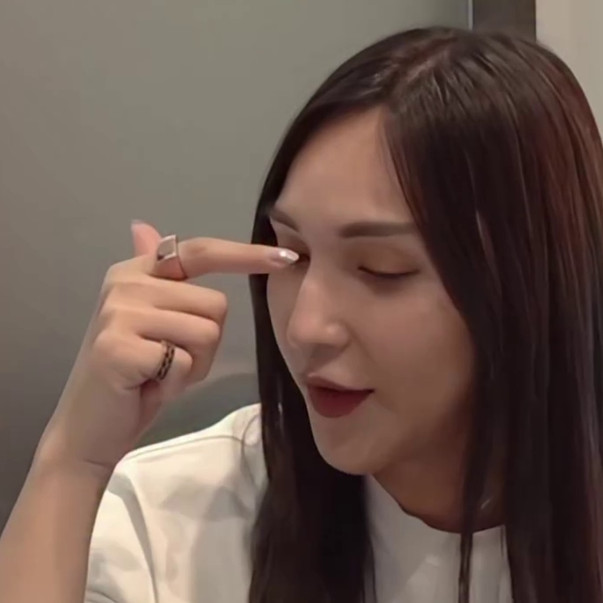 7 Potret Dena Rachman usai operasi plastik bagian hidung, dipuji makin cantik 