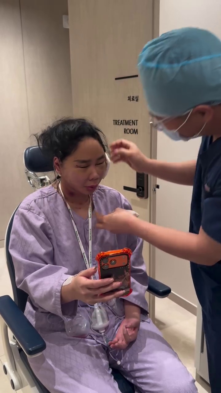 7 Potret Denise Chariesta jalani oplas wajah di Korea Selatan, ngaku habiskan dana Rp1 miliar