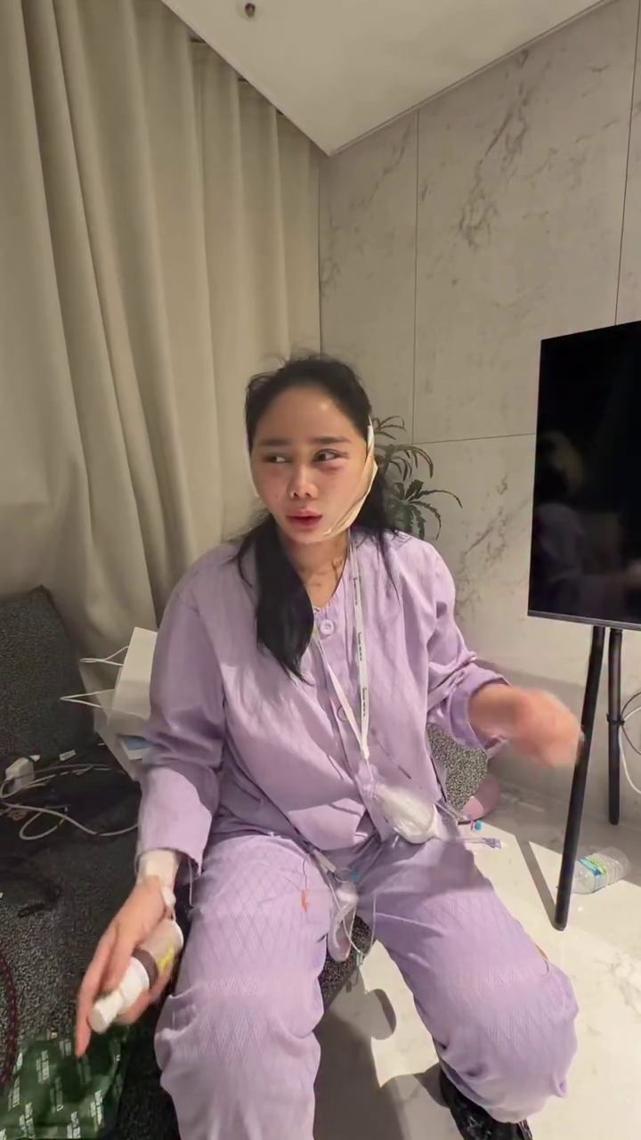 7 Potret Denise Chariesta jalani oplas wajah di Korea Selatan, ngaku habiskan dana Rp1 miliar