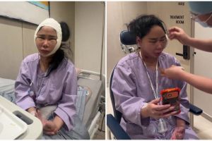 7 Potret Denise Chariesta jalani oplas wajah di Korea Selatan, ngaku habiskan dana Rp1 miliar