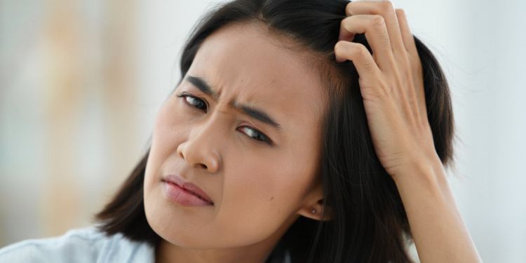 5 Cara mengatasi ketombe basah dengan bahan alami, ampuh dan aman dipakai rutin