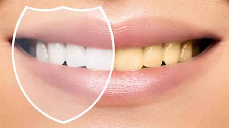 Trik hilangkan noda kuning membandel pada gigi pakai 1 jenis bahan minuman, bukan cuma kunyit