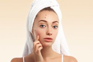 Tanpa serum acne, cara pudarkan bekas jerawat membandel pakai pemanis alami yang mudah dicoba