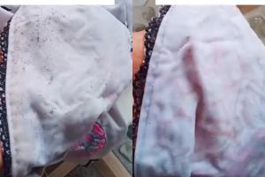 Noda jamur di pakaian bisa hilang dalam sekali usap, rahasianya ada di 1 bahan dapur ini