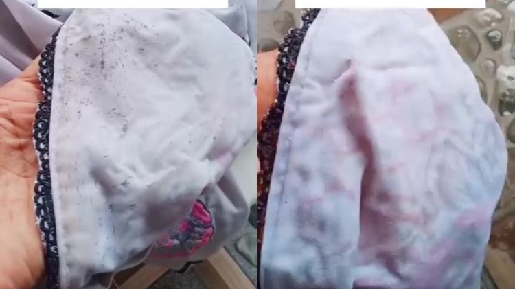 Noda jamur di pakaian bisa hilang dalam sekali usap, rahasianya ada di 1 bahan dapur ini