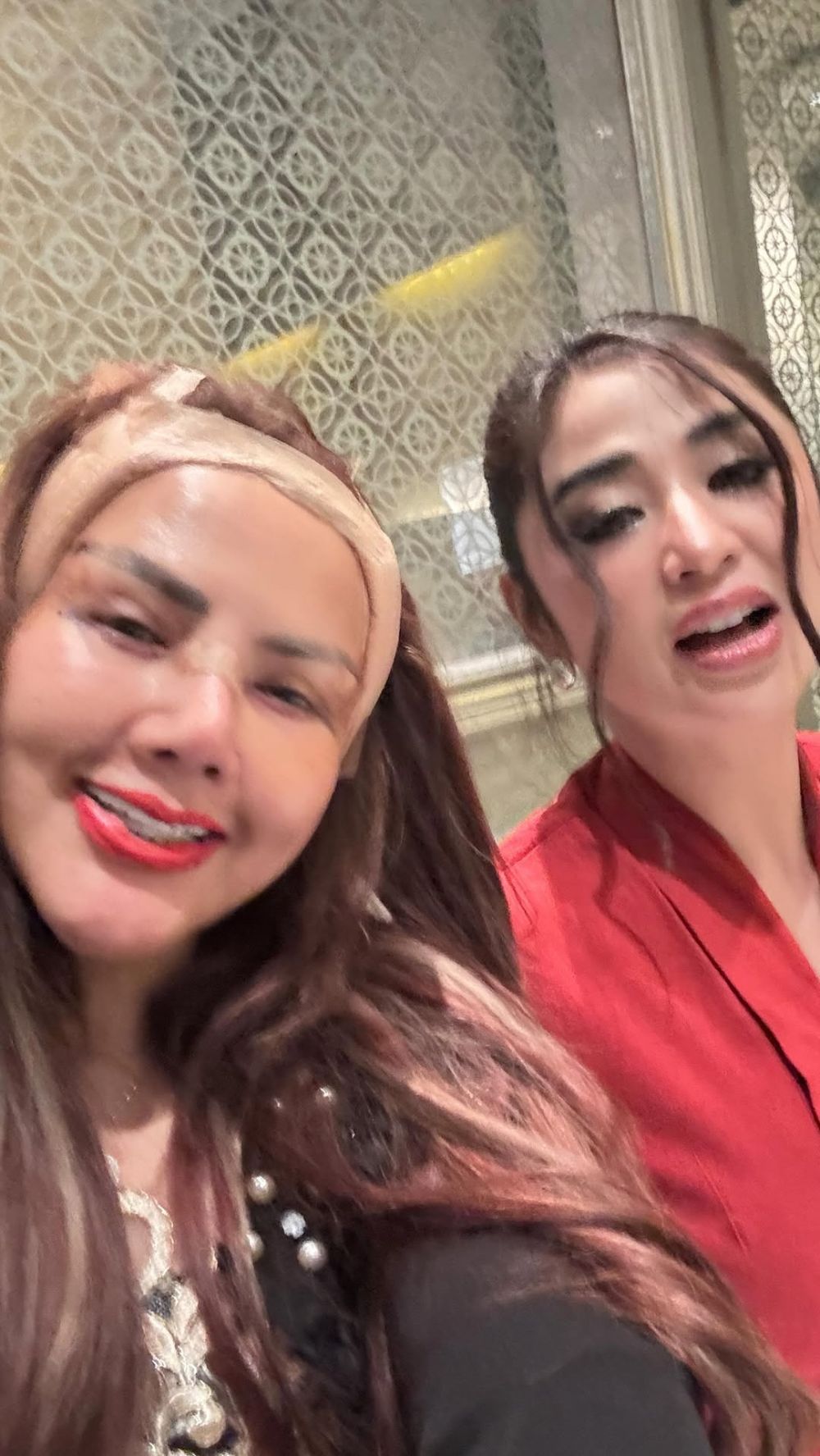 Menolak tua, Barbie Kumalasari sudah jalani operasi plastik 8 kali, ini 7 potret wajahnya kini