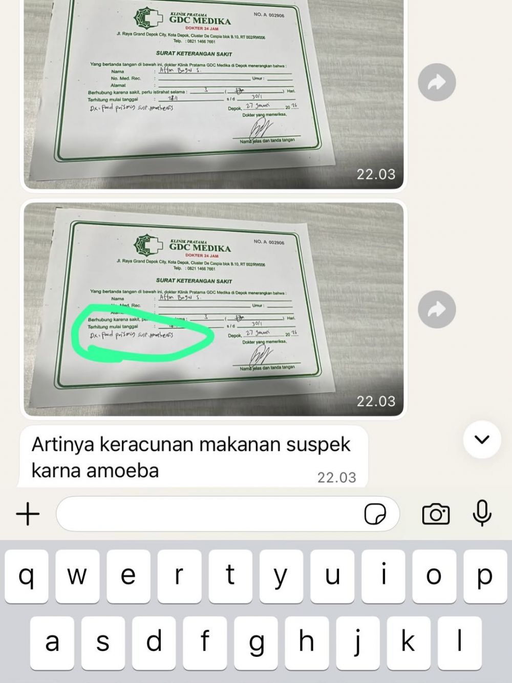 Kronologi Lisa Mariana sekeluarga keracunan kepiting Alaska, ibunda sampai dirawat di rumah sakit