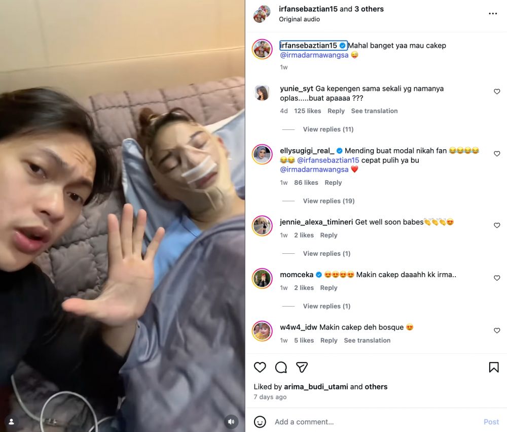 7 Potret Irma Darmawangsa pasca oplas, 3 hari setelahnya langsung main salju di Korea