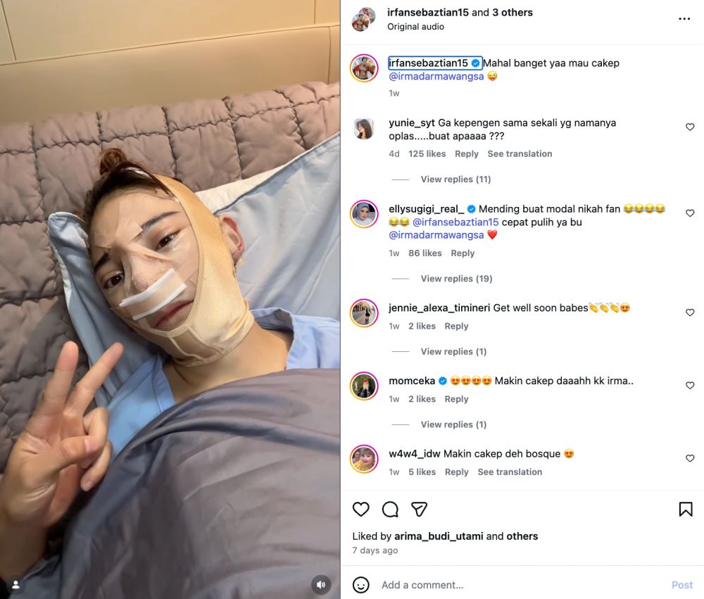 7 Potret Irma Darmawangsa pasca oplas, 3 hari setelahnya langsung main salju di Korea