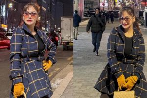 7 Potret Irma Darmawangsa pasca oplas, 3 hari setelahnya langsung main salju di Korea