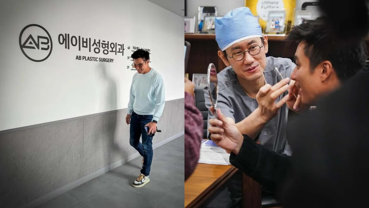 Klarifikasi Baim Wong soal isu operasi plastik, ternyata perawatan stem cell