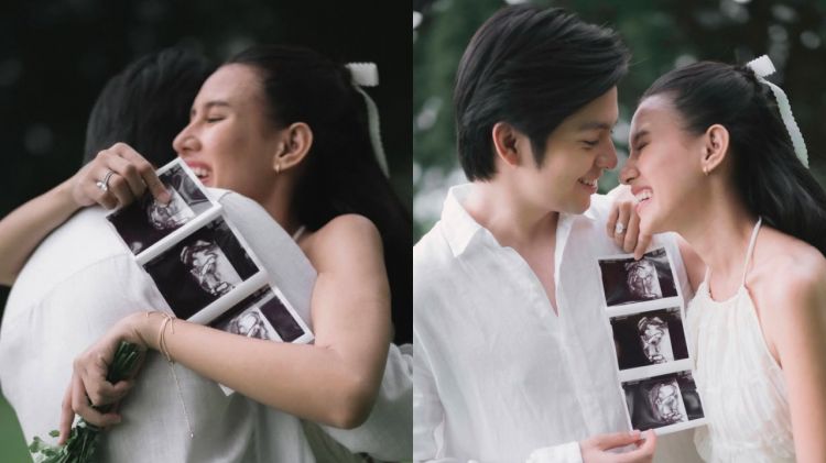 7 Potret maternity estetik Shenina Cinnamon dan Angga Yunanda, aura cantik bumil terpancar