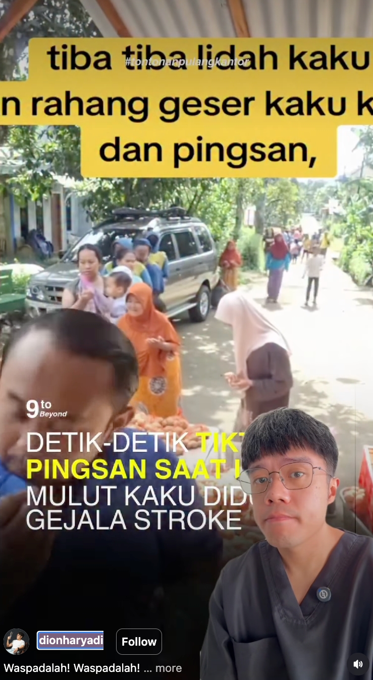 Kreator konten ini mendadak pelo saat live, kenali tanda awal stroke untuk penanganan segera