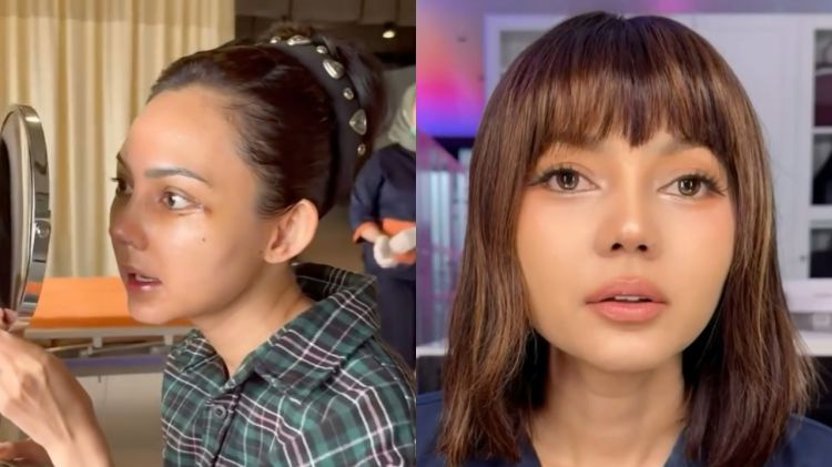 9 Potret Rina Nose pasca operasi hidung, hasil natural cantik tanpa bikin pangling