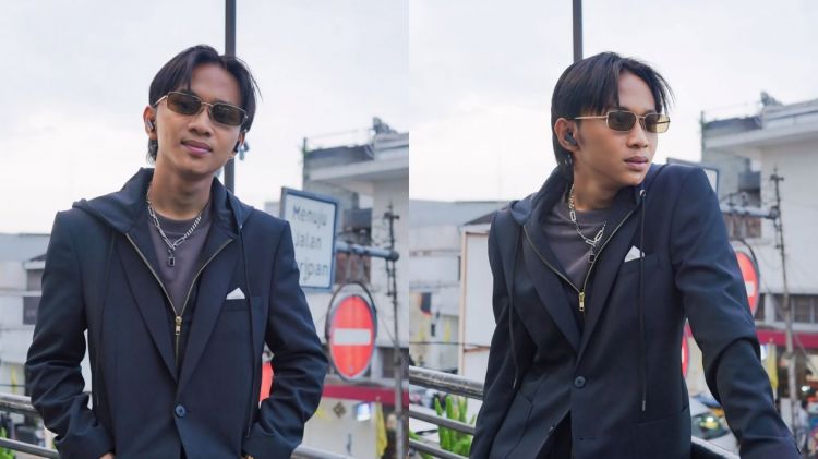 Kondisi terkini Fajar Sadboy usai kecelakaan akibat jalan licin, kuku copot hingga tulang cedera