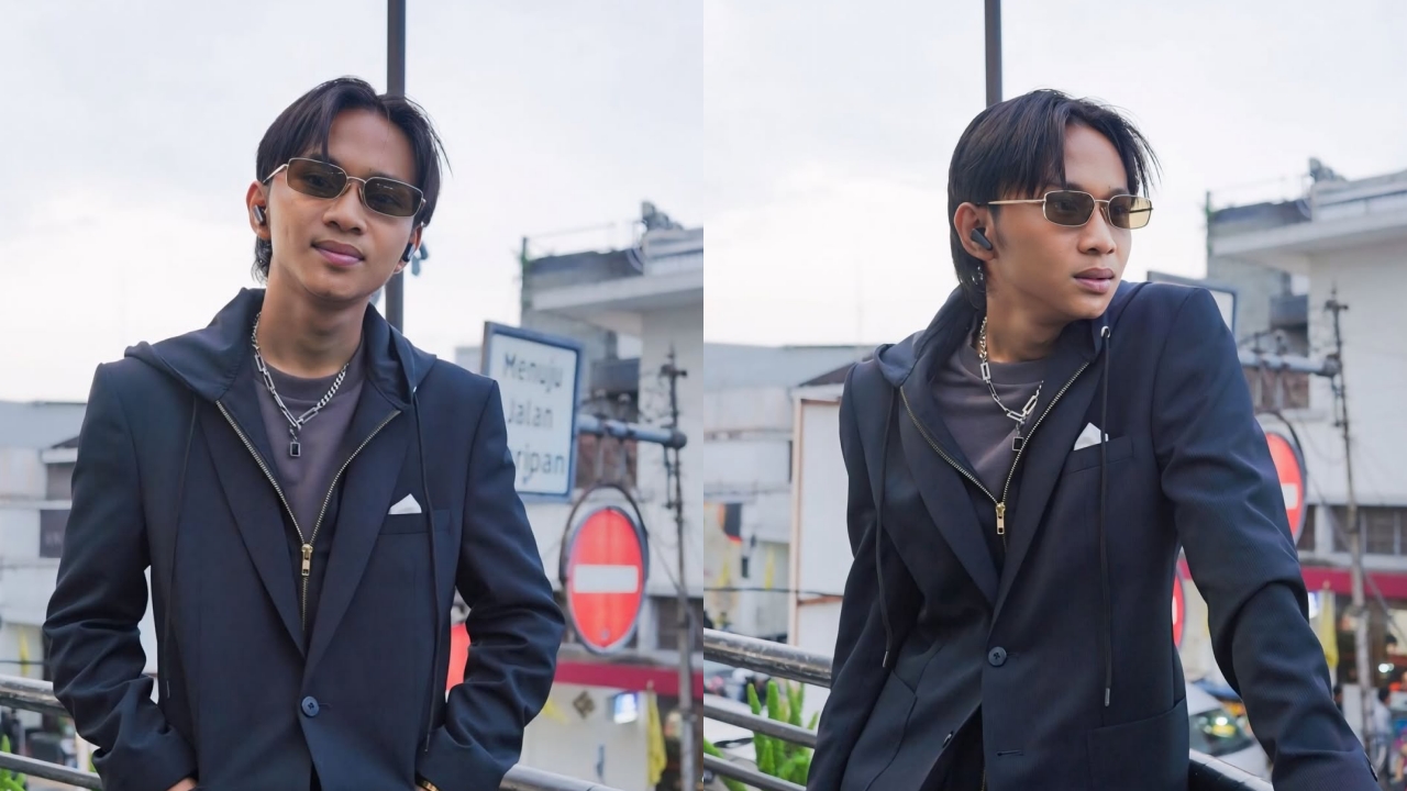 Kondisi terkini Fajar Sadboy usai kecelakaan akibat jalan licin, kuku copot hingga tulang cedera