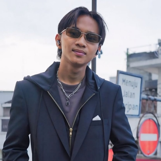 Kondisi terkini Fajar Sadboy usai kecelakaan akibat jalan licin, kuku copot hingga tulang cedera