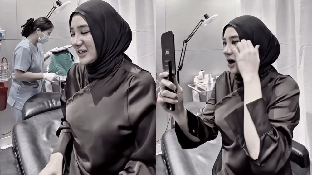 5 Potret terbaru Clara Shinta setelah operasi hidung, bikin orang pangling