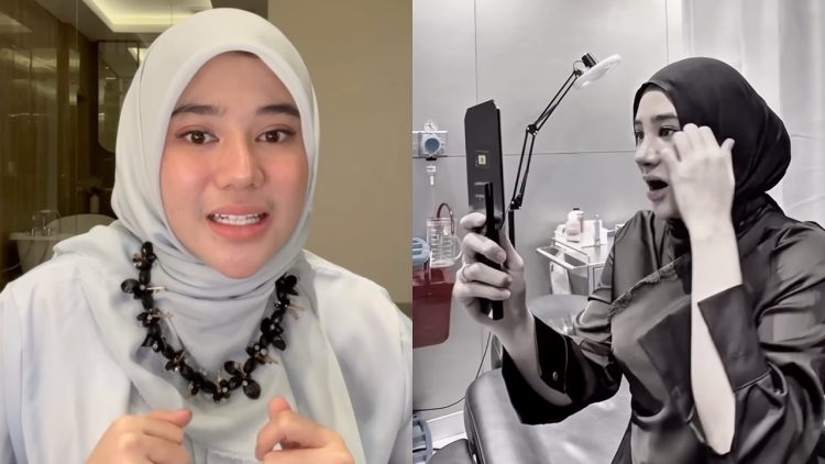 5 Potret terbaru Clara Shinta setelah operasi hidung, bikin orang pangling