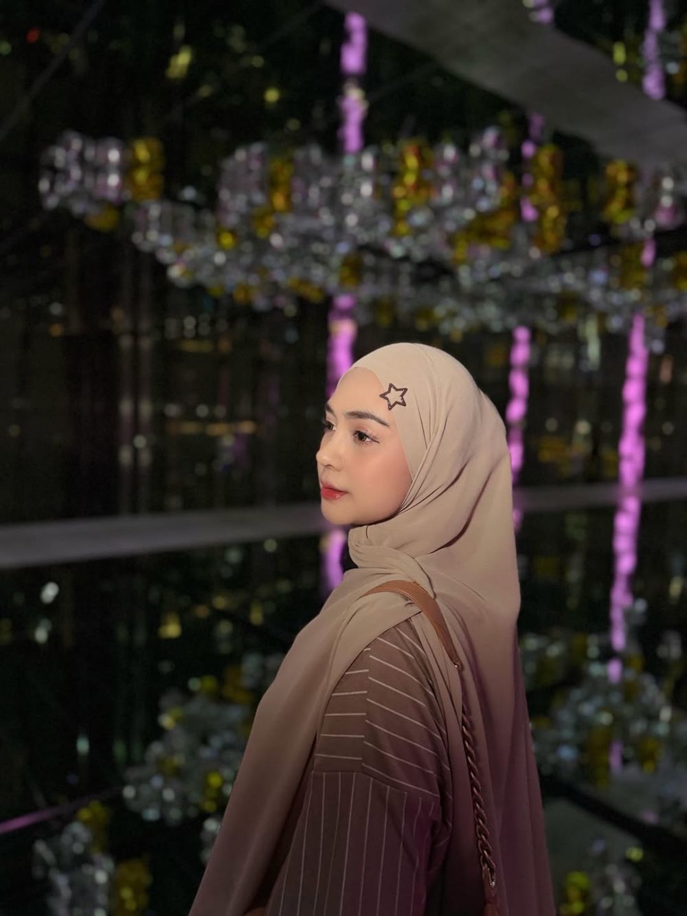 Bukan sekadar estetika, Ria Ricis ungkap alasan lakukan operasi tulang hidung