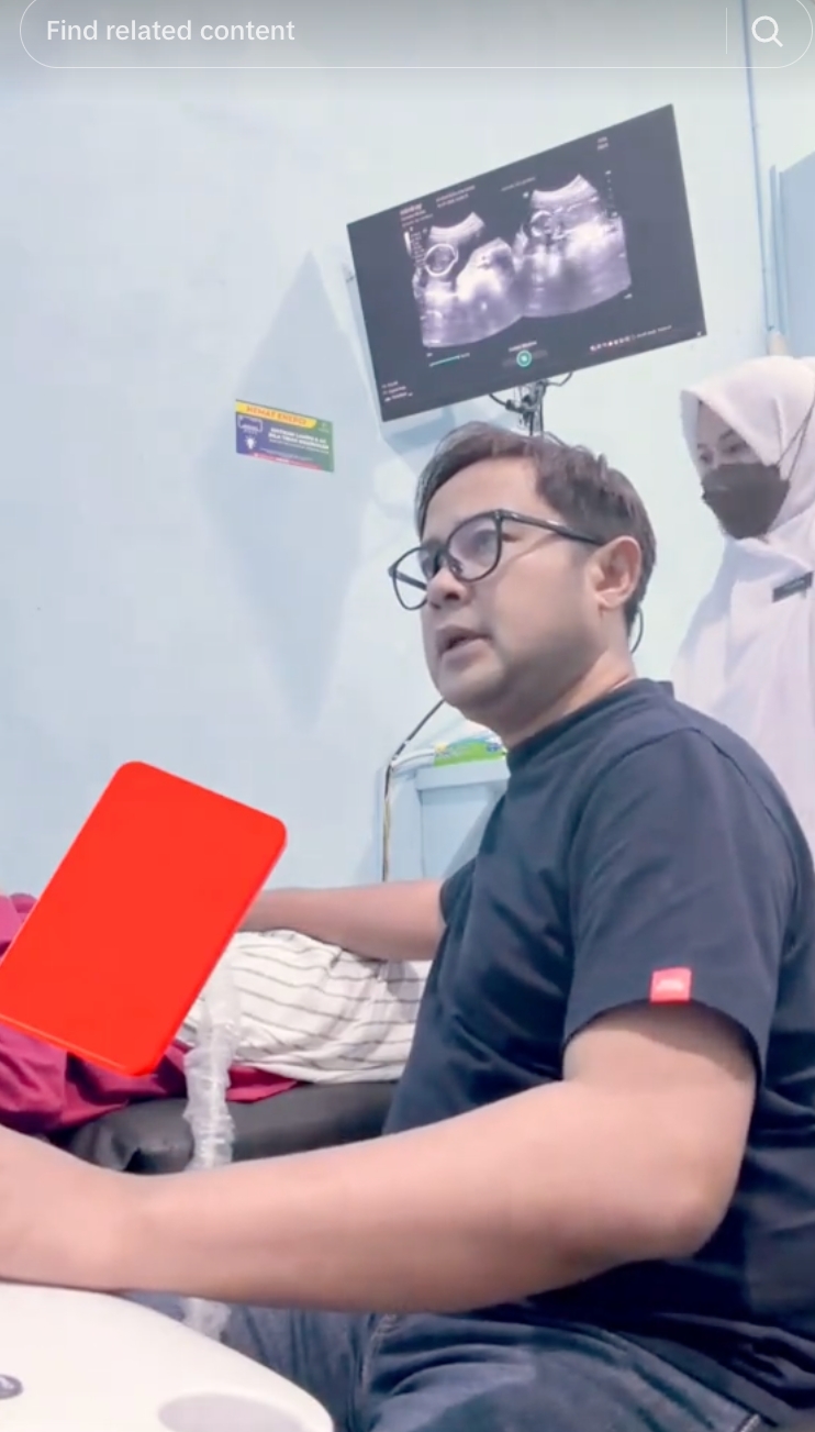 Detik-detik dokter obgyn kabarkan janin meninggal dunia lewat layar USG, momen periksa berubah total