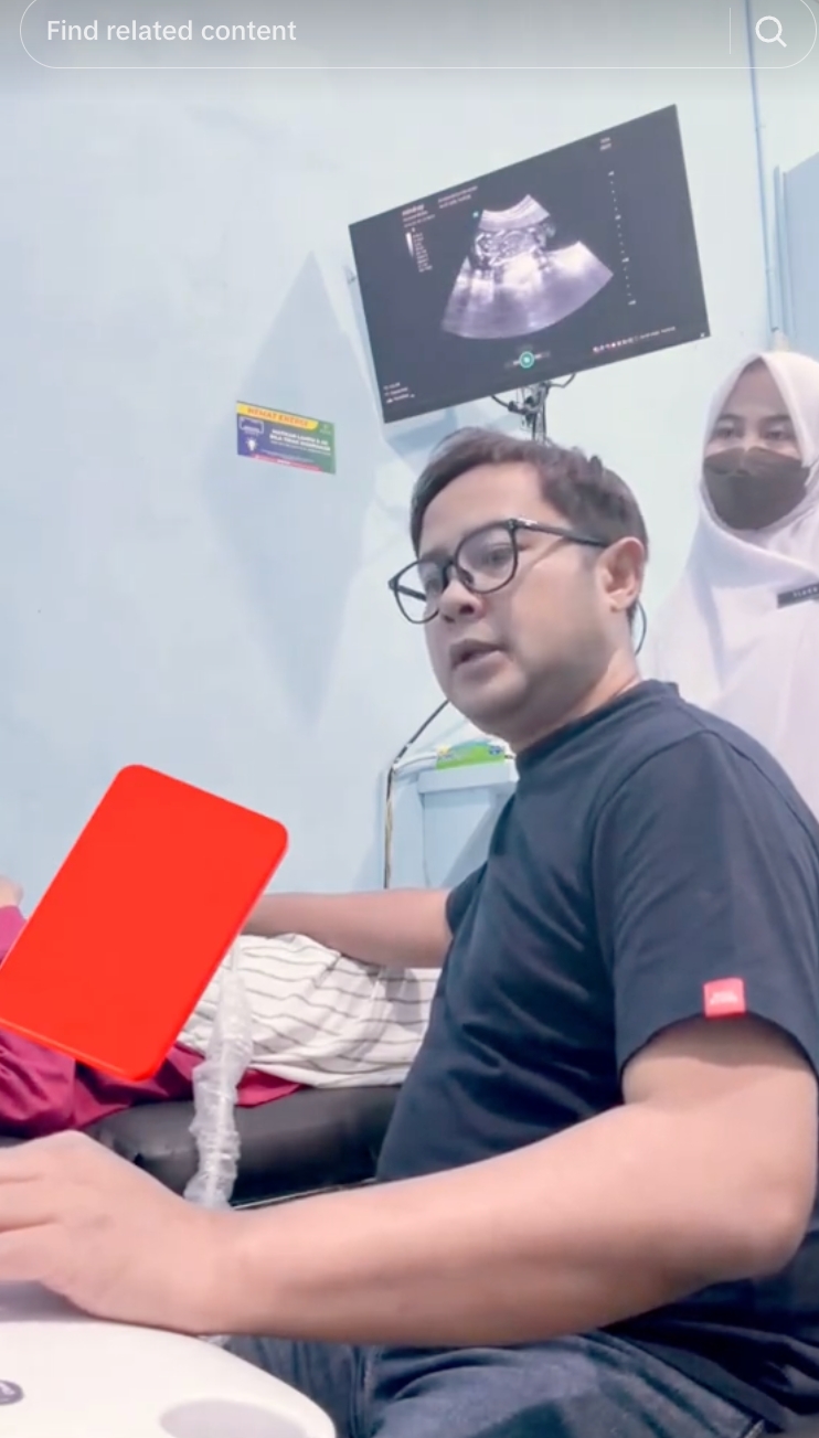 Detik-detik dokter obgyn kabarkan janin meninggal dunia lewat layar USG, momen periksa berubah total