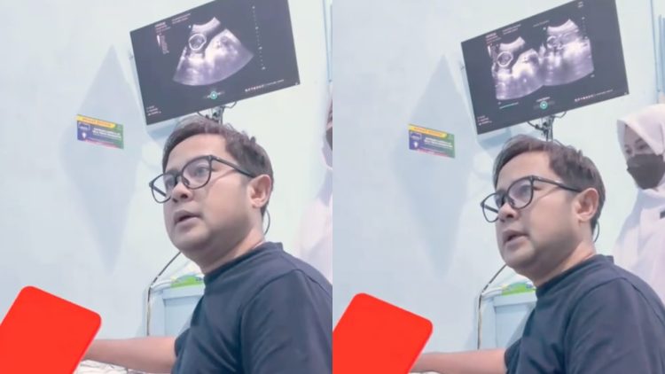 Detik-detik dokter obgyn kabarkan janin meninggal dunia lewat layar USG, momen periksa berubah total