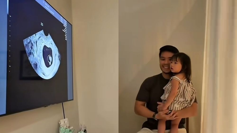 Jessica Mila kabarkan hamil anak kedua, reaksi Yakup Hasibuan bikin haru