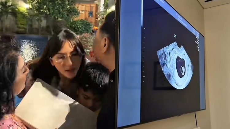 Jessica Mila kabarkan hamil anak kedua, reaksi Yakup Hasibuan bikin haru