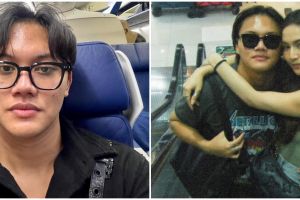 Ikuti jejak Mahalini operasi hidung, 5 penampilan terbaru Rizky Febian ini disebut bak beda orang