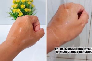 Bukan dioles pasta gigi, ini cara atasi kulit terkena minyak panas agar tak melepuh pakai 1 jenis buah