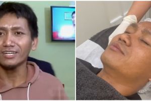 Mendadak jadi seleb, mukanya glowing, 9 transformasi Pegi Setiawan sebelum-usai perawatan di klinik