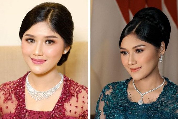 Gigi Rapi 9 Beda gaya Erina Gudono saat dan sesudah pakai behel, gigi rapi bikin ...