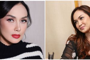 8 Seleb operasi plastik 3 kali atau lebih, ini perbedaan drastis sebelum dan sesudah permak wajah