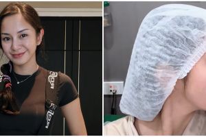 Akui permak hidung demi estetik, 9 potret terbaru Kirana Larasati ini dipuji, biar oplas tampak natura