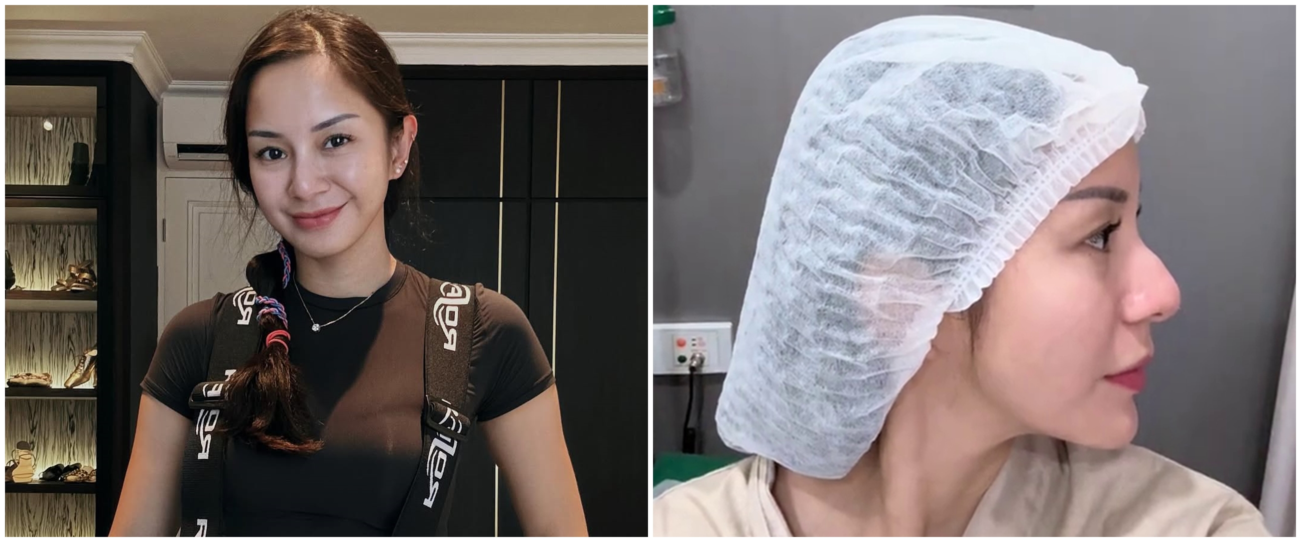 Akui permak hidung demi estetik, 9 potret terbaru Kirana Larasati ini dipuji, biar oplas tampak natura