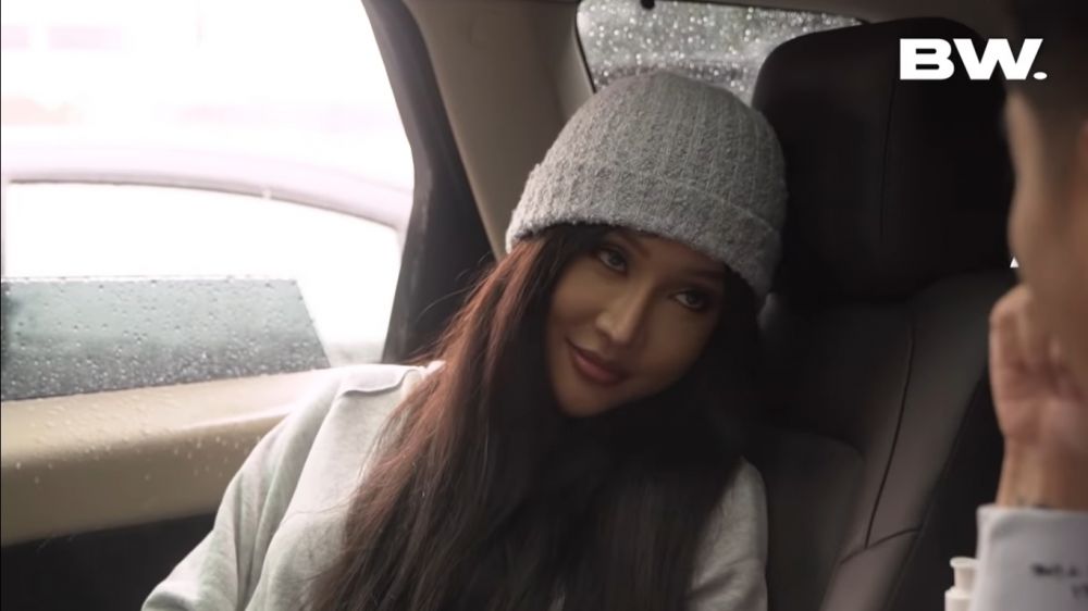 wajah baru Lucinta Luna usai operasi kepala © berbagai sumber wajah baru Lucinta Luna usai operasi kepala © berbagai sumber