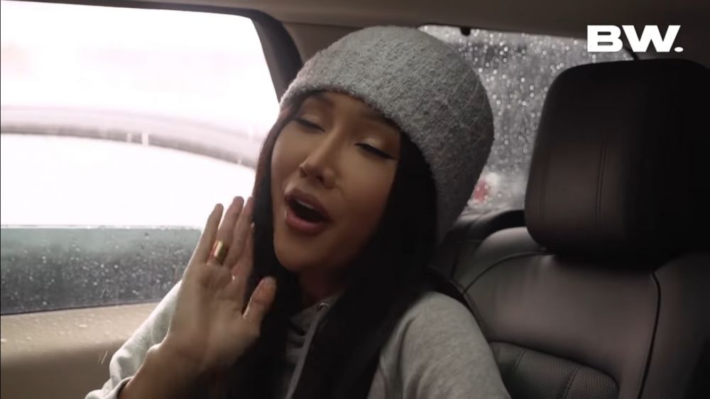 wajah baru Lucinta Luna usai operasi kepala © berbagai sumber wajah baru Lucinta Luna usai operasi kepala © berbagai sumber