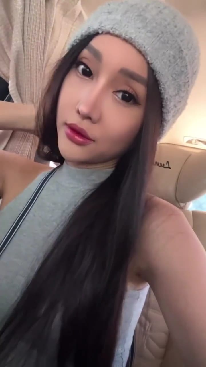 potret baru lucinta luna usai oplas © berbagai sumber