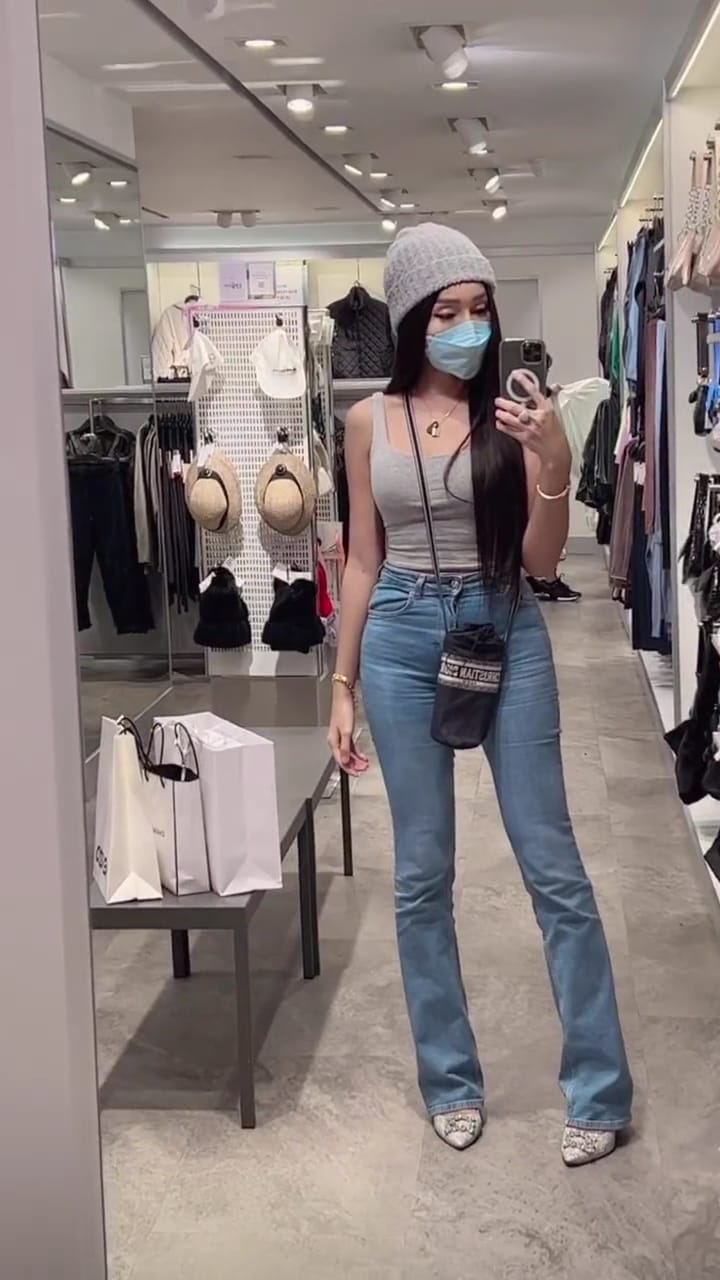 potret baru lucinta luna usai oplas © berbagai sumber