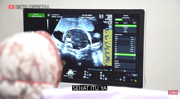 momen ria ricis cek kandungan © YouTube